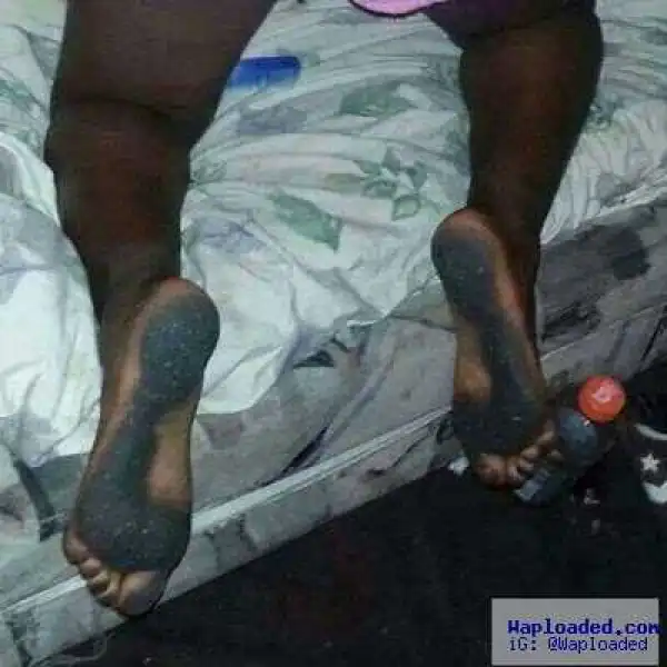 Ewwwww!!! What will you do? (Photo)